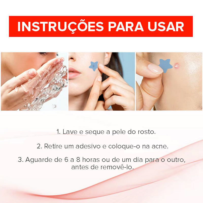 Acne Patch - Seu Segredo Para Uma Pele Perfeita!